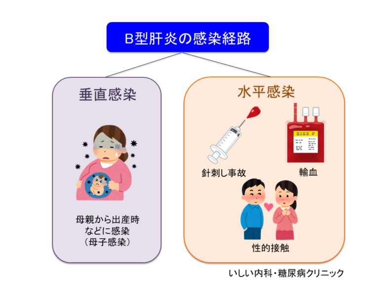  A型肝炎とは何ですか?