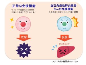 自己免疫不全